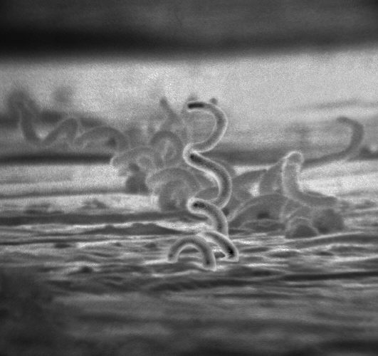 Syfilis – tajemnicza i wstydliwa choroba skóry